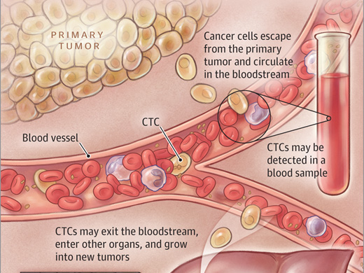 CytoQuest CR液体活检—CellSearch的卓越助力肿瘤精准医疗的替代方案